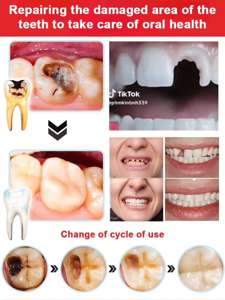 【3-Day White Teeth】Newly upgraded probiotic care toothpaste🦷