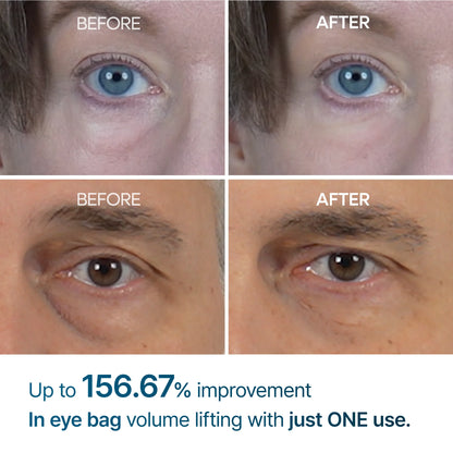 Eyephalt Eyebag Cream💦👁️