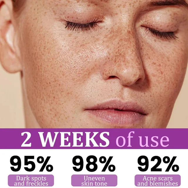 Highly effective anti-pigmentation serum💦