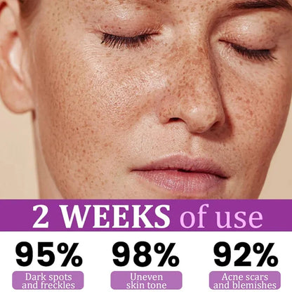 Highly effective anti-pigmentation serum💦