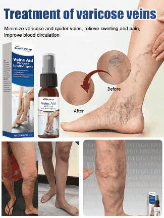 Leg Vein Treatment Spray🌱