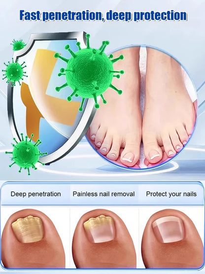 Ginger Nail Care Solution✨