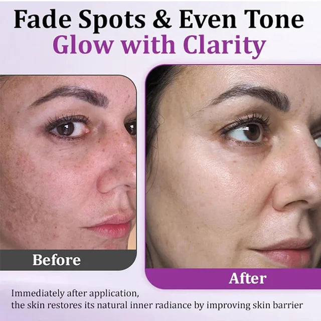 Highly effective anti-pigmentation serum💦