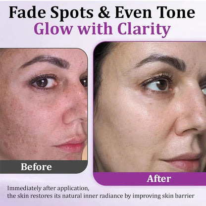 Highly effective anti-pigmentation serum💦