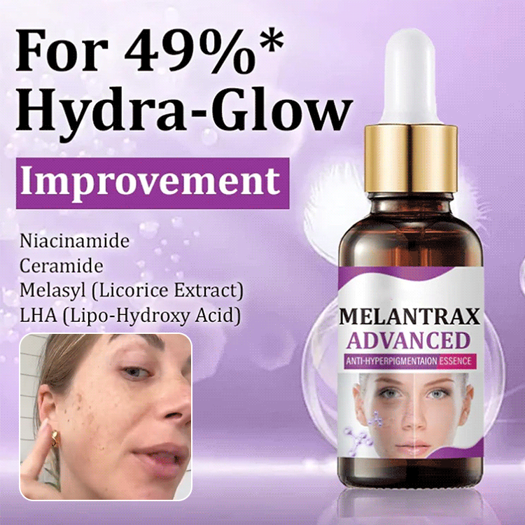 Highly effective anti-pigmentation serum💦