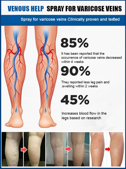 Leg Vein Treatment Spray🌱