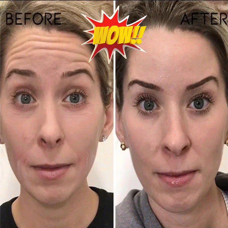 Hyaluronic acid essence💦