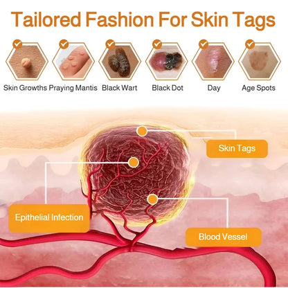 Patch Wart Flesh Mole Acne Patch Beauty Skin Care No Pain Easy To Operate🌟