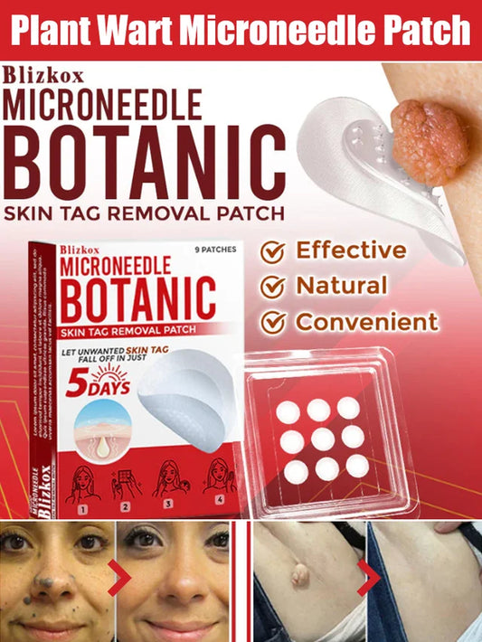 Plant Wart Microneedle Patch🌟