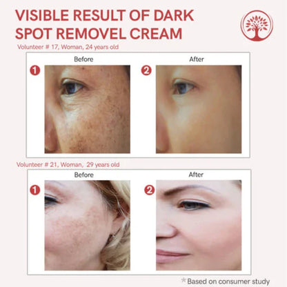 Celimax Whitening Cream - Reduce Dark Spots & Pigmentation | Minimize Open Pores💦