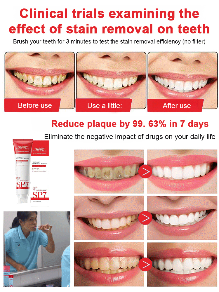 【3-Day White Teeth】Newly upgraded probiotic care toothpaste🦷