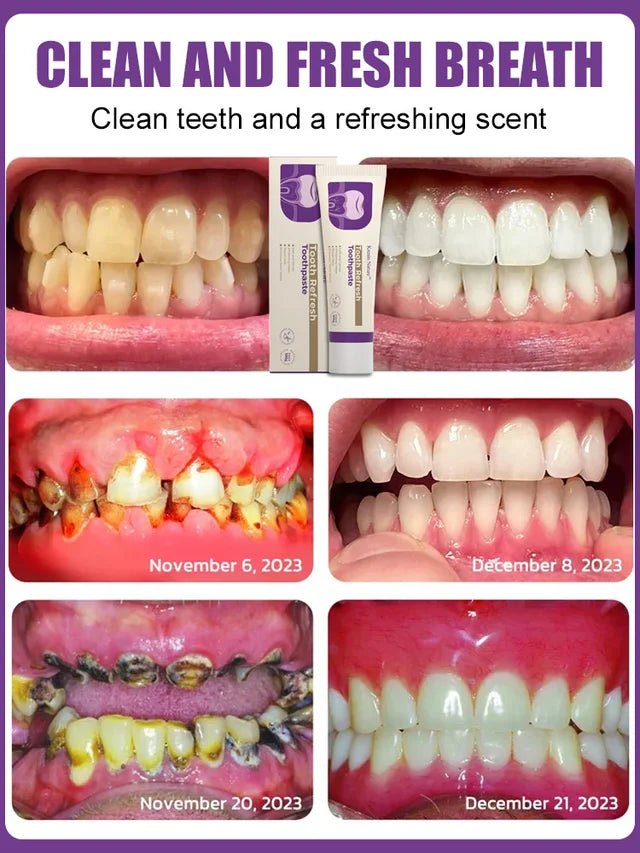 Toothpaste for whitening and gum protection🦷