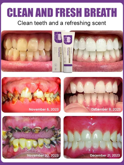 Toothpaste for whitening and gum protection🦷