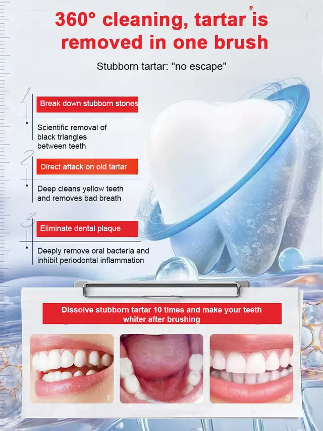 【3-Day White Teeth】Newly upgraded probiotic care toothpaste🦷