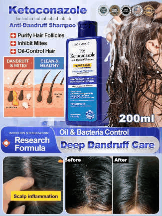 1% Ketoconazole Anti-Dandruff Shampoo💦💦