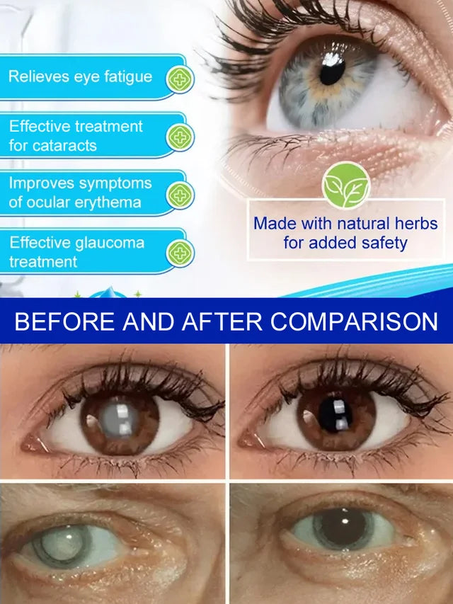 [Cataract Specialist] Eye Care Patch👁️💦