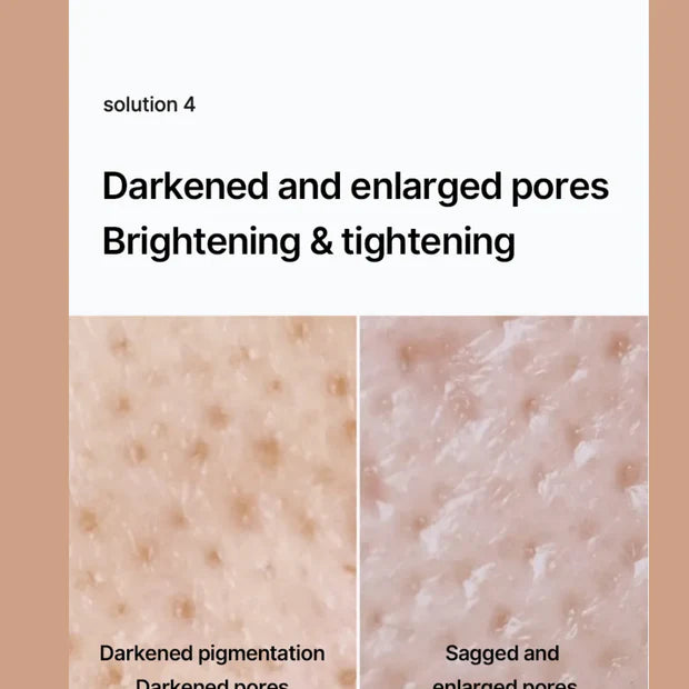 Celimax Whitening Cream - Reduce Dark Spots & Pigmentation | Minimize Open Pores💦