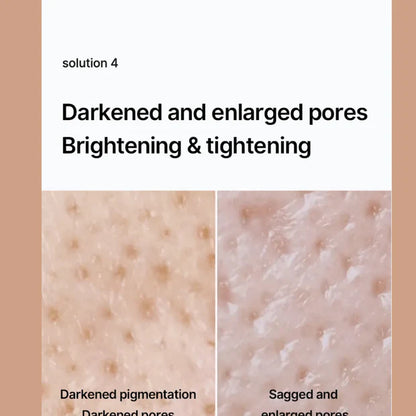 Celimax Whitening Cream - Reduce Dark Spots & Pigmentation | Minimize Open Pores💦