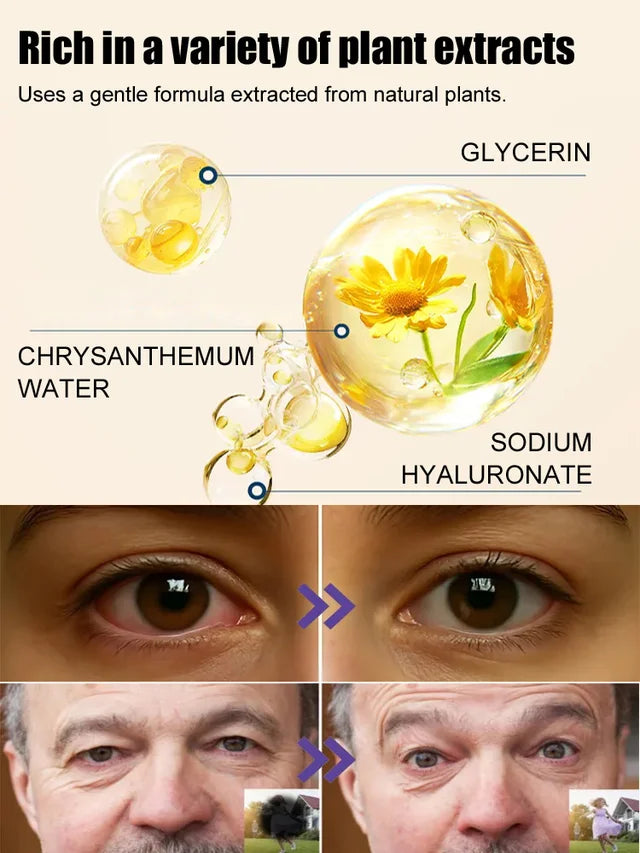 [Cataract Specialist] Eye Care Patch👁️💦