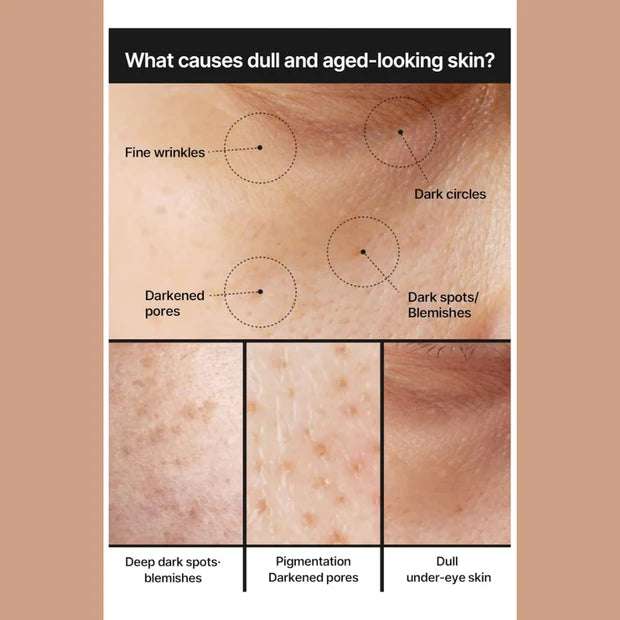 Celimax Whitening Cream - Reduce Dark Spots & Pigmentation | Minimize Open Pores💦