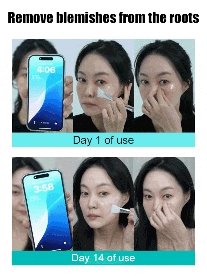 Spot-Removing & Skin-Rejuvenating Collagen Peel-Off Mask💦