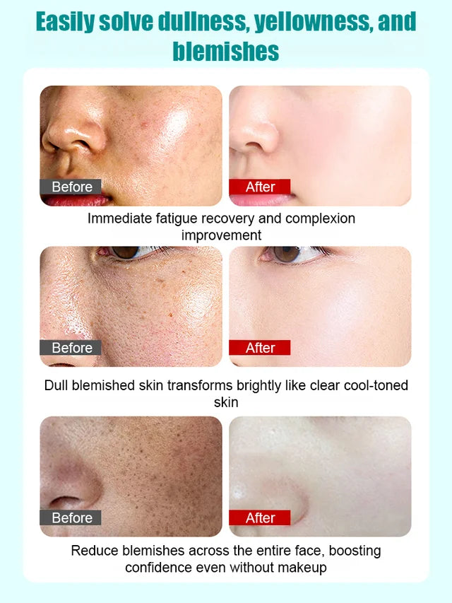 Spot-Removing & Skin-Rejuvenating Collagen Peel-Off Mask💦