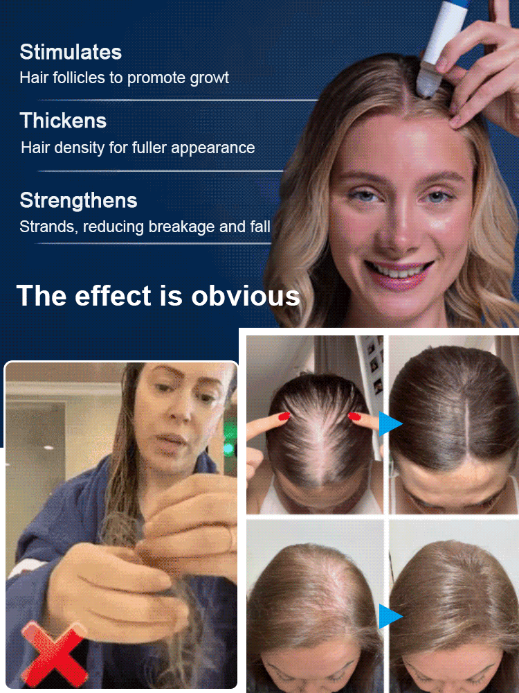 Rosemary Hair Growth Roll-On⚡