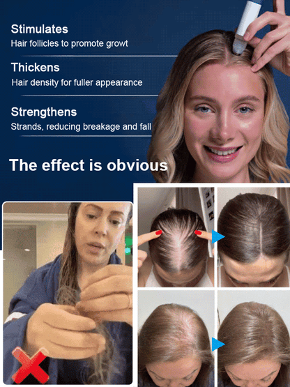 Rosemary Hair Growth Roll-On⚡