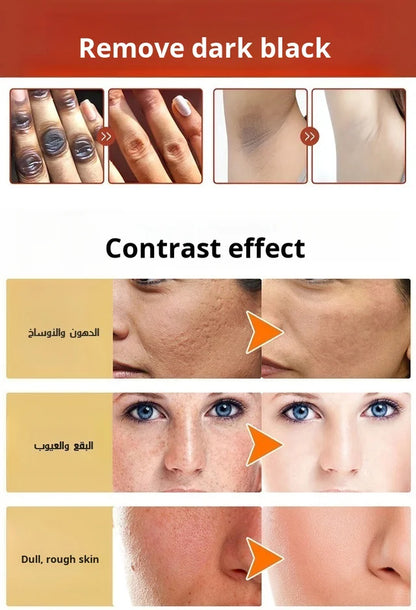 Deep Cleansing Peeling Oil Skin Care Dead Skin Blemish Lightening Brightening Exfoliating Oil✨