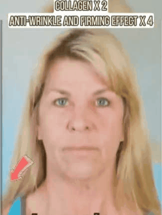 Retinol Anti-Wrinkle Cream💦