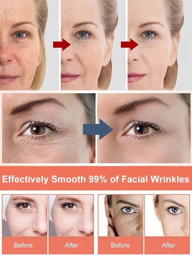 [Anti-Wrinkle and Yellowing Reduction] Professional Facial Anti-Wrinkle Cream💦