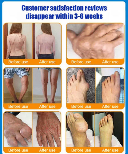 All-body joint relief gel⚡