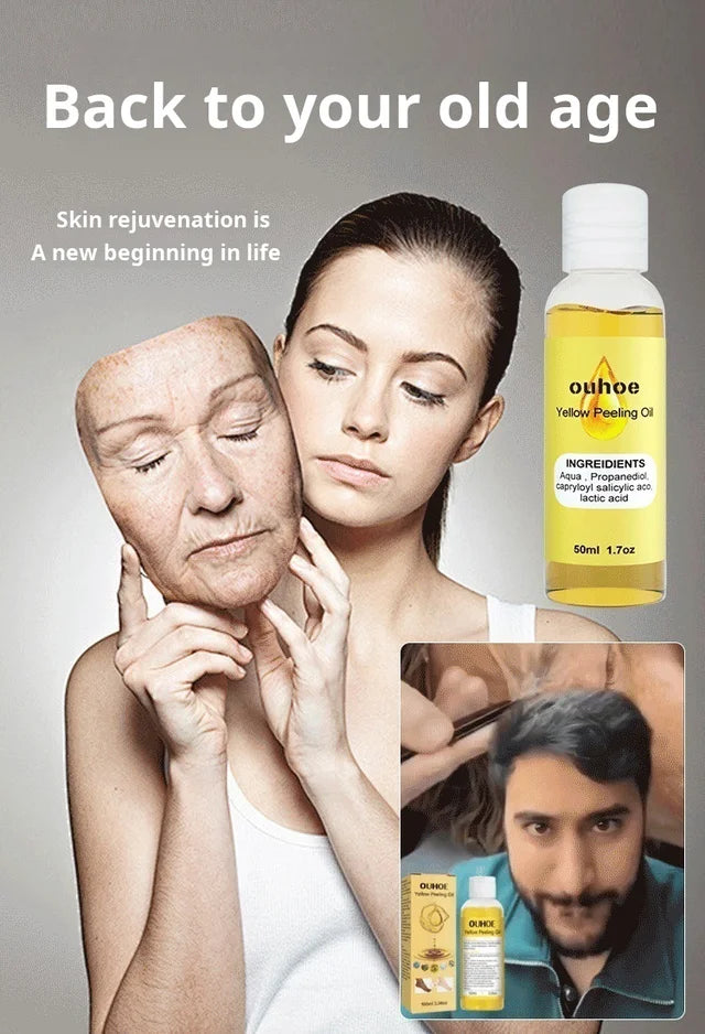 Deep Cleansing Peeling Oil Skin Care Dead Skin Blemish Lightening Brightening Exfoliating Oil✨