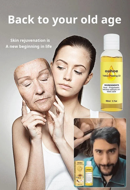 Deep Cleansing Peeling Oil Skin Care Dead Skin Blemish Lightening Brightening Exfoliating Oil✨