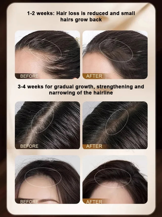 [Overnight Hair Growth] Hair Regrowth & Thickening Spray🌟