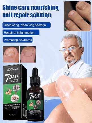 Ginger Nail Care Solution✨