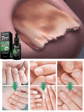 Ginger Nail Care Solution✨