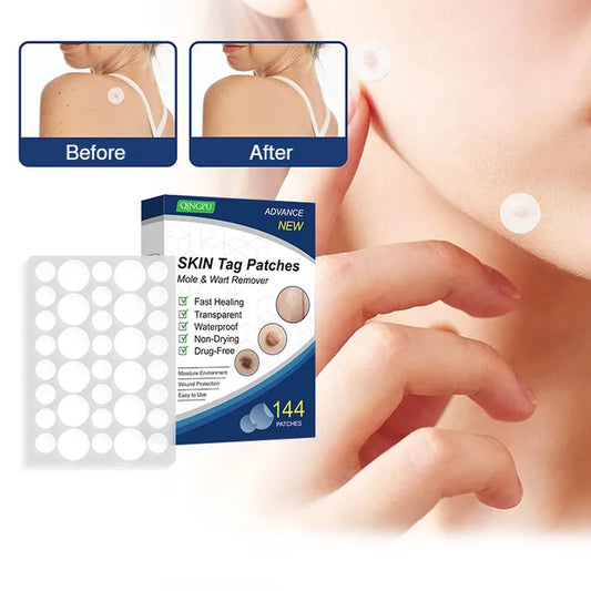 Patch Wart Flesh Mole Acne Patch Beauty Skin Care No Pain Easy To Operate🌟