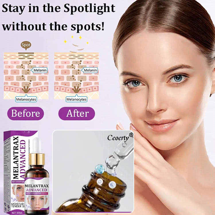 Highly effective anti-pigmentation serum💦