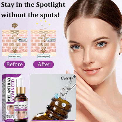 Highly effective anti-pigmentation serum💦