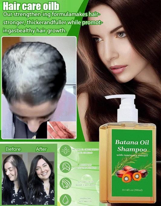 【Rapid hair growth in 7 days!】Hair growth shampoo💦💦