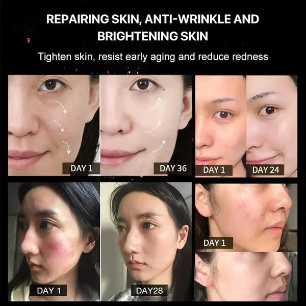 Bee Venom Facial Cream💦