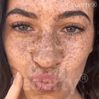 Highly effective anti-pigmentation serum💦