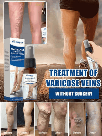 Leg Vein Treatment Spray🌱