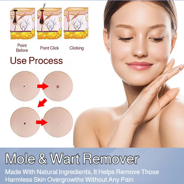 Patch Wart Flesh Mole Acne Patch Beauty Skin Care No Pain Easy To Operate🌟