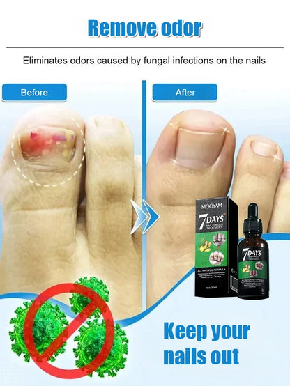 Ginger Nail Care Solution✨