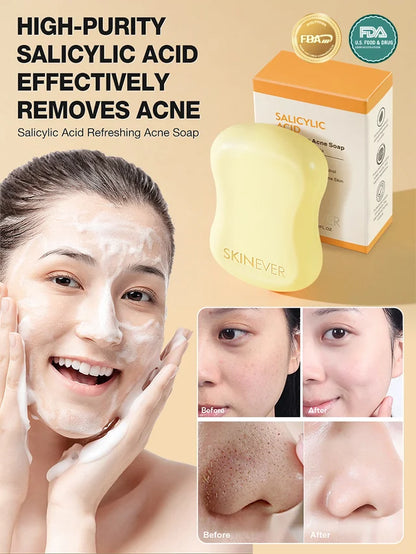 [Washes away 99.9% of dust mites] Salicylic acid soap🧼