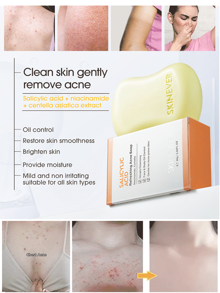 [Washes away 99.9% of dust mites] Salicylic acid soap🧼