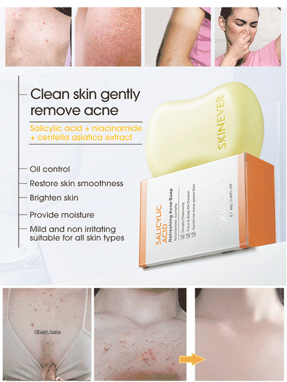 [Washes away 99.9% of dust mites] Salicylic acid soap🧼