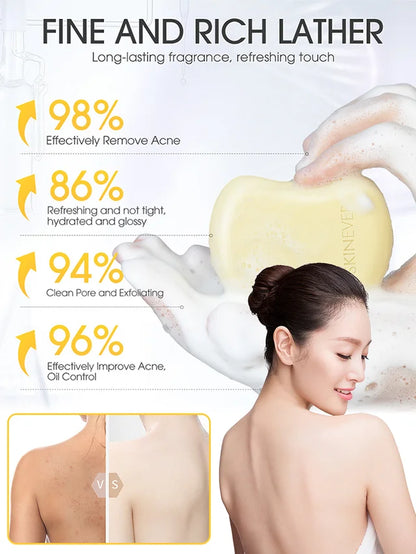 [Washes away 99.9% of dust mites] Salicylic acid soap🧼